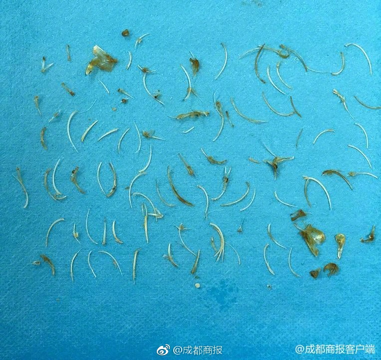 上门服务先付款是不是真的 _ app大爆炸,上门服务后付款是真的么